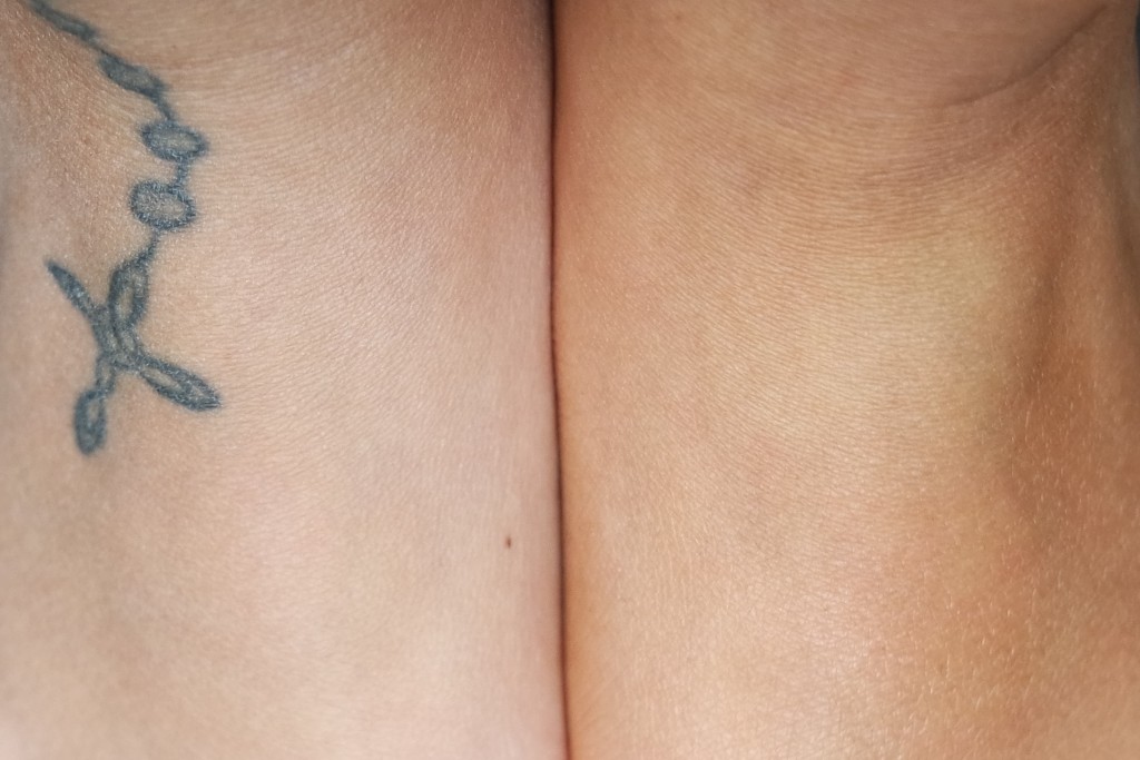 Benefit Zero Tanlines Before After 02