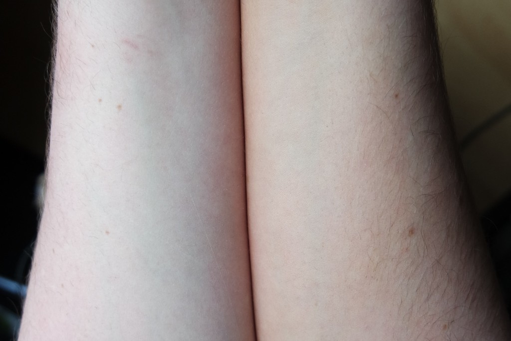 Benefit Zero Tanlines Before After 03